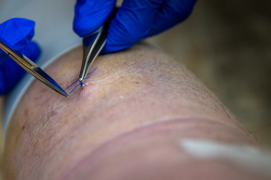 Verbeter je Gezondheid met Transdermale Supplement Patches